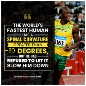 Scoliosis and Usain Bolt