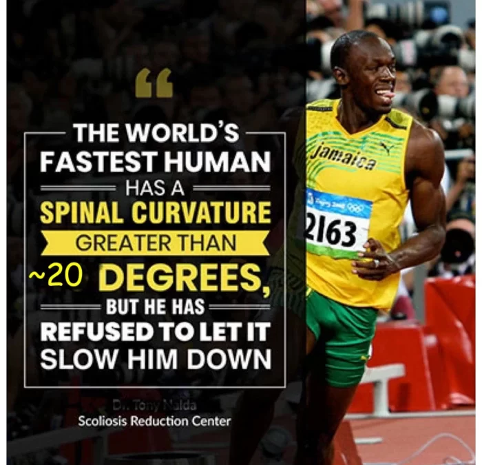 Scoliosis and Usain Bolt