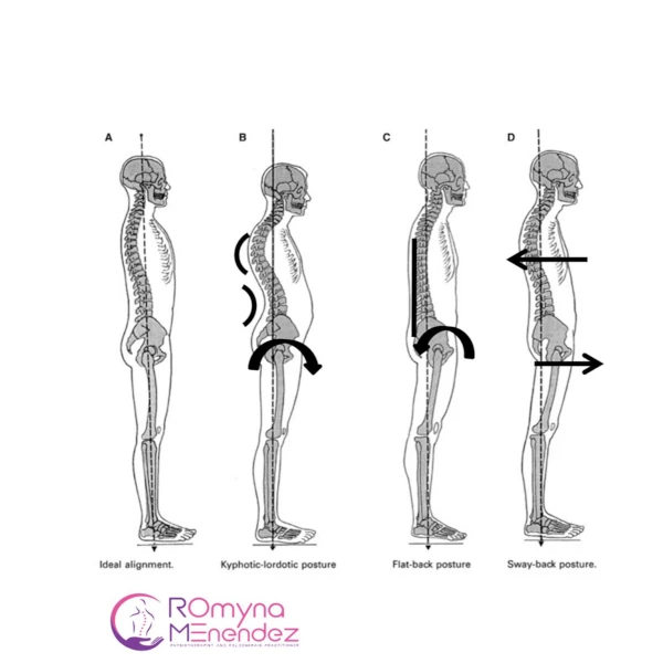 Ideal alignment and uncorrect postures