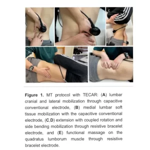 Use of Tecartherapy
