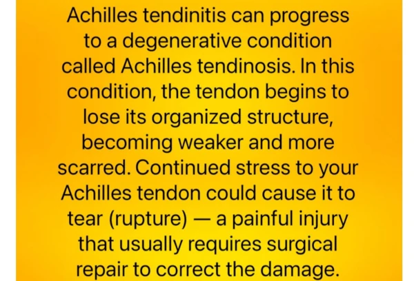 Achilles Tendonitis Symptoms
