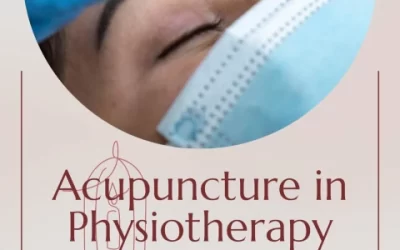 We offer acupuncture as part of our physiotherapy treatment