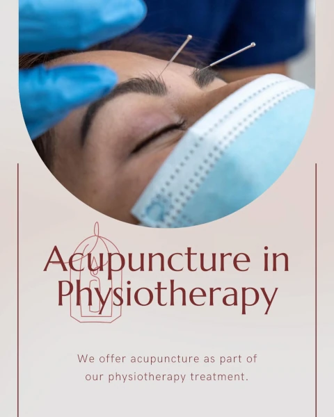 We offer acupuncture as part of our physiotherapy treatment